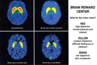 Gallery Photo of Brain activity