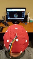 Gallery Photo of What a qEEG brain mapping session looks like.