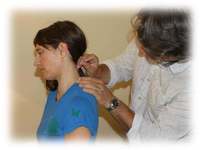 Gallery Photo of Acupuncture is included in our program.