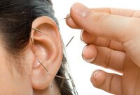 Gallery Photo of If you choose to, you can get to receive ear acupuncture that is helpful in regulating your nervous systems for better.