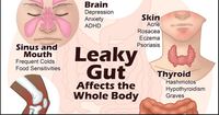 Gallery Photo of Leaky gut is the root cause of almost all diseases! functional medicine says, "always heal the gut first" and "when in doubt, heal the gut first!"